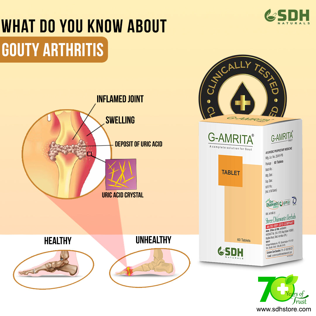 SDH Naturals G Amrita Tablets: Your Natural Solution for Gout and Joint Pain Relief. Maintain Healthy Uric Acid Levels, Reduce Swelling, and Relieve Pain. Discover the Ayurvedic Pack of 60 Tablets for Optimal Joint Care